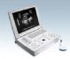 laptop portable ultrasound scanner bw8h